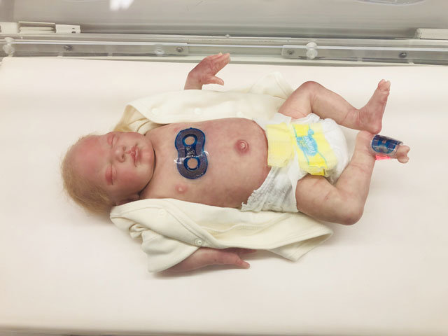 새로 개발된 신생아 무선 센서를 신생아 인형에 장착했다. 어른 손가락 두 마디 크기의 얇은 파스 형태지만 혈압과 체온 등 다섯 가지 의료정보를 실시간으로 측정해 무선전송할 수 있다. 노스웨스턴대 제공