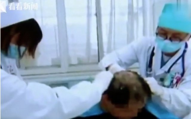 병원 의료진이 환자의 머리를 삭발하고 있다. 칸칸뉴스 갈무리