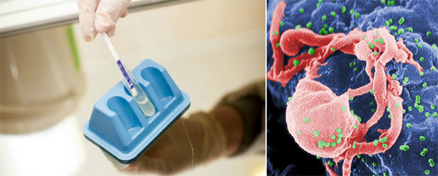 HIV 진단하는 모습. 오른쪽 사진은 인간 면역세포인 백혈구에 침투한 HIV(녹색)의 모습이다. ·WHO·NIH 제공