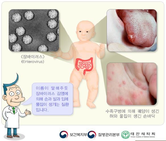 사진=질병관리본부