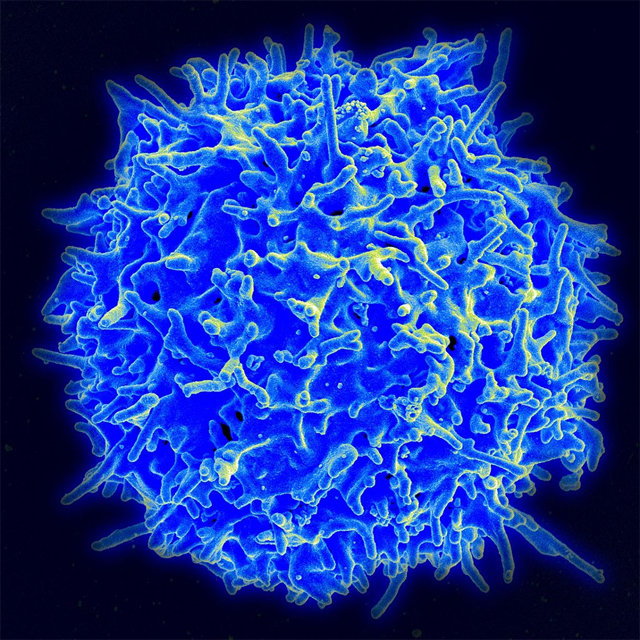 암세포를 잡는 면역세포. 면역항암제는 이 세포가 암세포를 더 잘 인식해 공격하도록 돕는 신개념 항암제다. 주로 암세포의 회피 능력을 제어한다. 미국국립보건원 제공