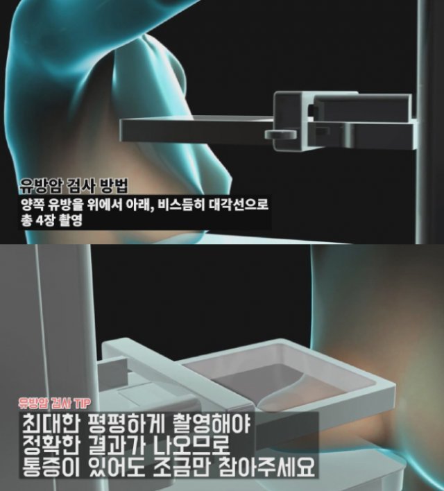 [유방 엑스레이 촬영검사 애니메이션 캡처]