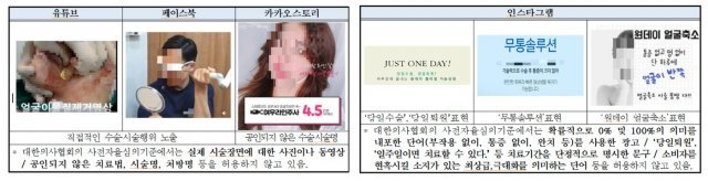 의료법 위반 의심광고 유형(한국소비자원 제공)© 뉴스1