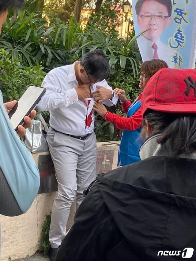 허쥔야오(주니어스 호) 홍콩 입법회 의원이 6일 구의원 선거 지원유세 도중 괴한이 휘두른 흉기에 찔린 뒤 옷에 묻은 피를 닦아내고 있다. (홍콩 사우스차이나모닝포스트) © 뉴스1