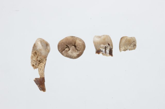 익산 쌍릉 대왕묘에서 출토된 치아 일부. 국립전주박물관 제공