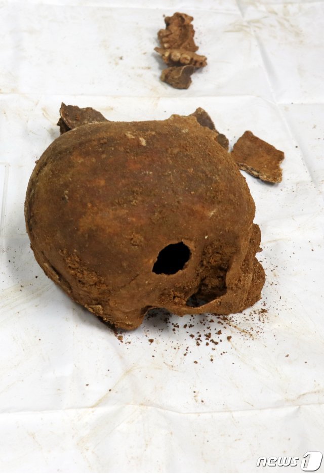 광주시와 5월 단체가 40여구의 유골이 발견된 옛 광주교도소 내 무연고 합장묘 인근 터를 추가 발굴한다. 사진은 발굴된 유골 중 구멍이 뚫린 머리뼈의 모습. (5·18 기념재단 제공)/뉴스1 © News1 DB