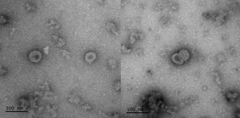 코로나19 바이러스항원(Spike)으로 구성된 바이러스유사체 투과전자현미경 (TEM) 이미지. 질병관리본부 국립보건연구원 제공