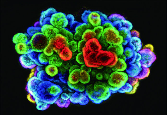오가노이드는 ‘미니 장기’로 불린다. 왼쪽 사진은 2009년 네덜란드 휘브레흐트연구소가 만든 장 오가노이드. 장을 이루는 다양한 세포를 서로 다른 형광물질로 염색했다. 휘브레흐트연구소 제공