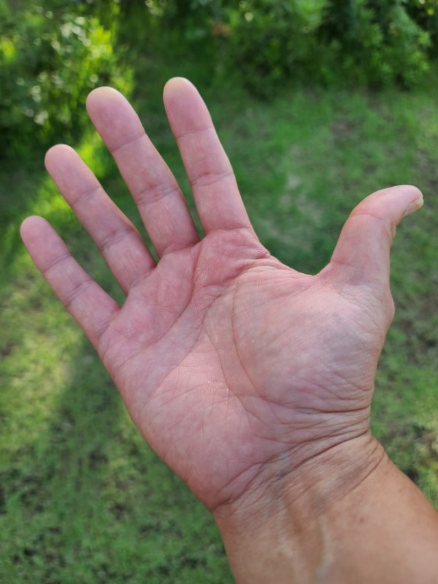 2010년 복귀 이후 10년 동안 마운드를 지키게 한 송창식의 오른손. 버거씨병의 흔적은 말끔히 사라졌다. 송창식 제공