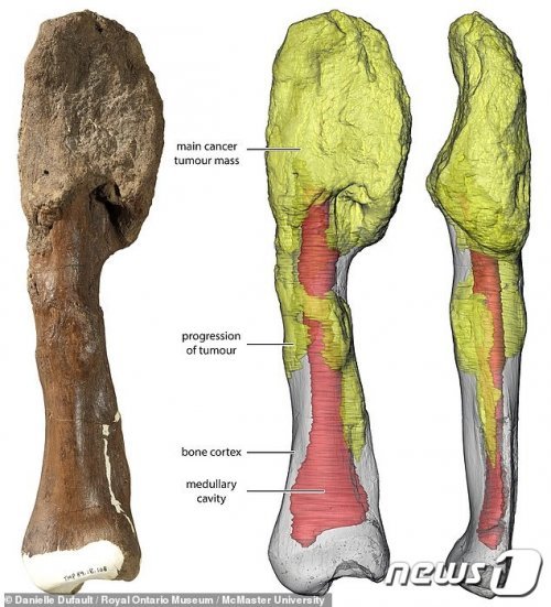 7700만년전 센트로사우루스 화석 뼈 . 골육종 덩어리가 보인다. (캐나다온타리오 왕립박물관) © 뉴스1