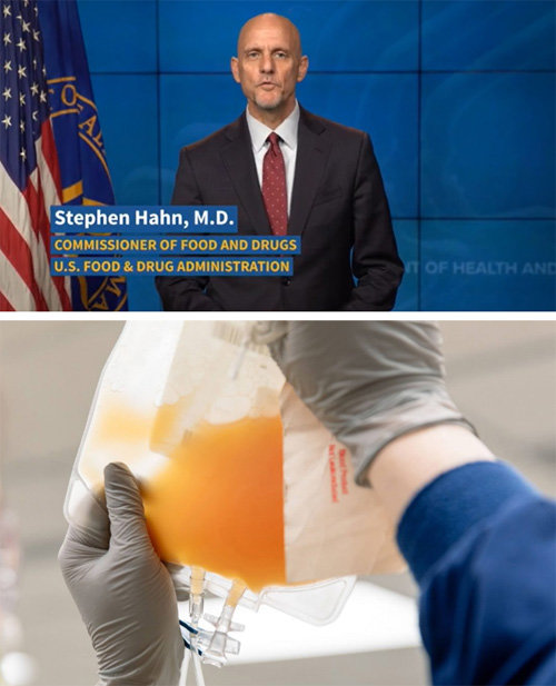 스티븐 한 미국 식품의약국(FDA) 국장이 코로나19 완치자들의 혈장 공여를 요청하고 있다. 아래 사진은 사람 혈액에서 적혈구나 백혈구 등 혈구를 뺀 액체가 혈장. 적혈구를 뺐기 때문에 누런빛을 띤다. FDA 동영상 캡처·메이오 클리닉 제공