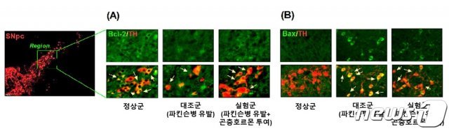 파킨슨병 유발 동물 모델에서 도파민 세포 내 마이토콘드리아 활동 분석 결과© 뉴스1