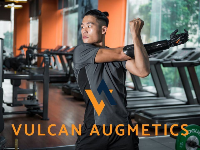 Vulcan Augmetics 로봇팔 이미지, 출처: Vulcan Augmetics
