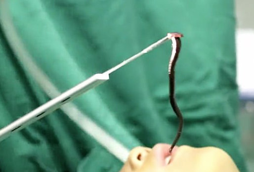 병원이 공개한 수술 사진·영상