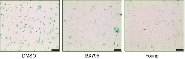 노화한 진피 섬유아세포(왼쪽 사진)와 PDK1 억제제를 투여해 노화 상태에서 다시 젊은 상태로 되돌린 섬유아세포의 모습(가운데 사진). 노화 이전의 젊은 섬유아세포(오른쪽 사진)와 비슷하게 변했다. KAIST 제공