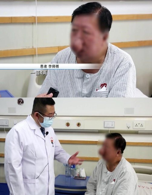 ‘코끼리 코’로 불편함을 호소한 리 씨. 병원 측은 장기간 음주에 따른 피부 염증으로 진단내렸다.