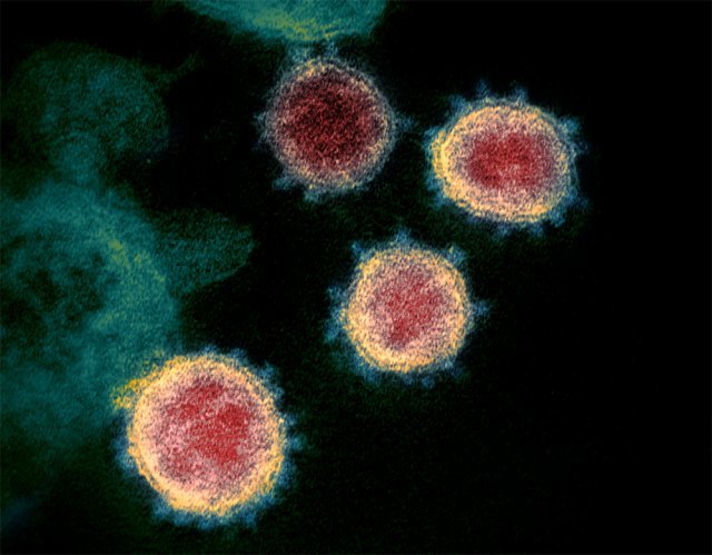 코로나19 바이러스의 모습. 표면에 있는 돌기 모양의 스파이크 단백질에 변이가 생기면 감염력이 높아지거나 항체에 대한 면역 회피 능력이 생길 수 있다. 최근 인도에서 신종 코로나바이러스 감염증 미국 국립알레르기전염병연구소(NIAID) 제공