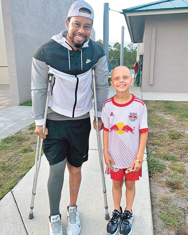 루나 페로네 SNS