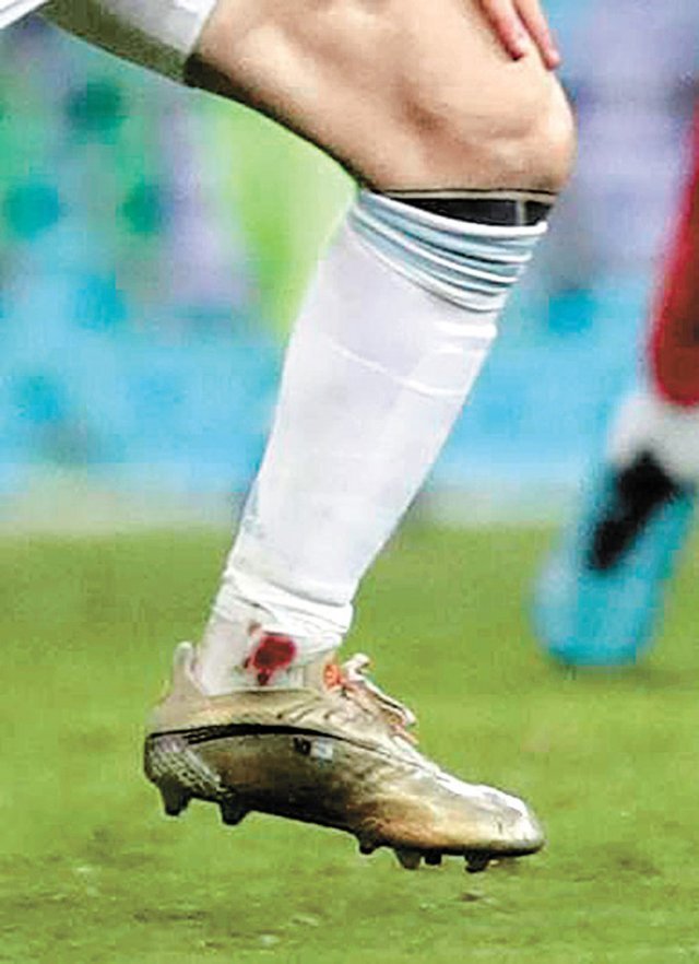 후반 3분 콜롬비아 프랑크 파브라의 태클에 왼쪽 발목이 찍혀 피로 물든 리오넬 메시의 스타킹. 브라질리아=AP 뉴시스