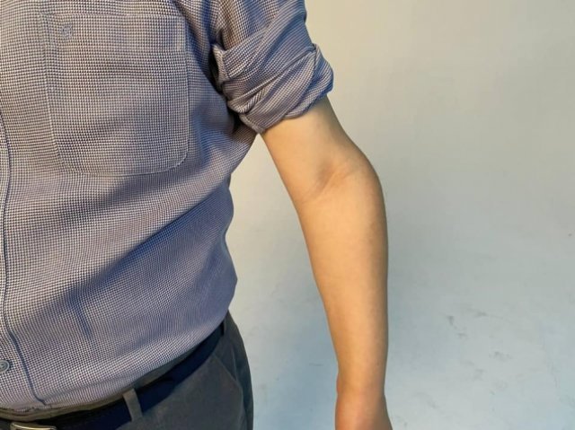 더불어민주당 대권 주자인 이재명 경기도지사가 ‘군 미필’ 논란에 대해 휘어진 왼팔 사진을 공개하며 정면 대응에 나섰다. 이 지사 페이스북