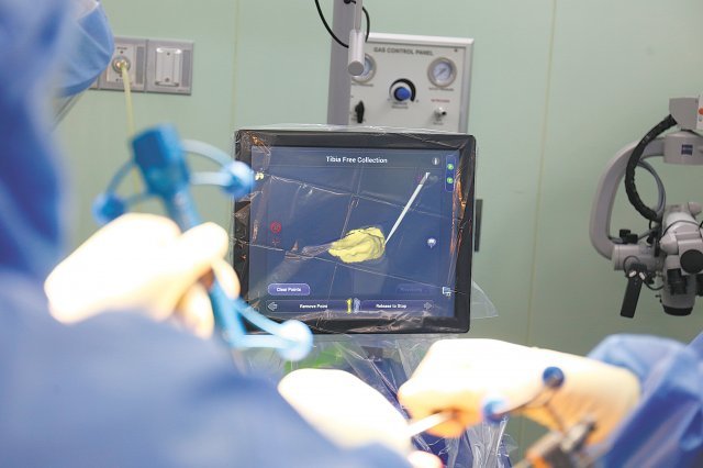 로봇을 통해 환자의 무릎 관절 표면을 실시간 3D 영상으로 구현할 수 있다.