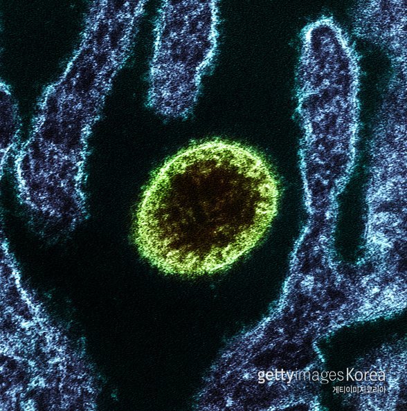 현미경 아래 ‘니파’(Nipah) 바이러스(연두색). ⓒ게티이미지