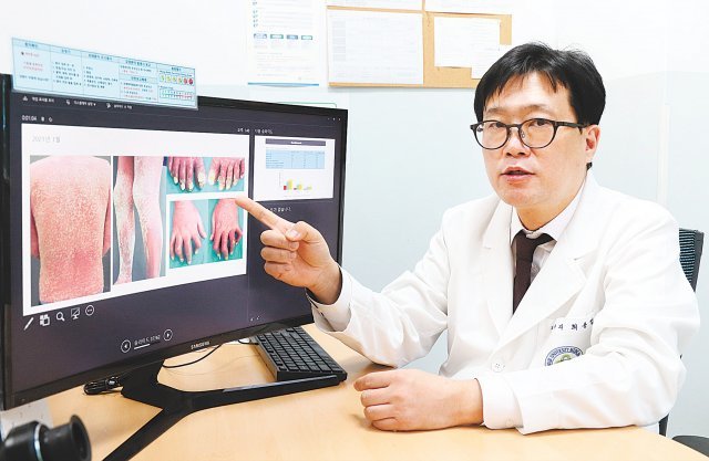 건선은 최신 치료 약제 출시로 과거에 비해 치료 효과가 많이 개선됐다. 하지만 아직도 많은 환자가 건선 치료를 기피하거나 잘못된 치료로 고통받고 있다. 사진은 최용범 대한건선학회 회장. 대한건선학회 제공