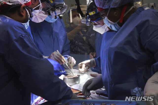 이식 수술을 집도하는 의료진들. 뉴시스