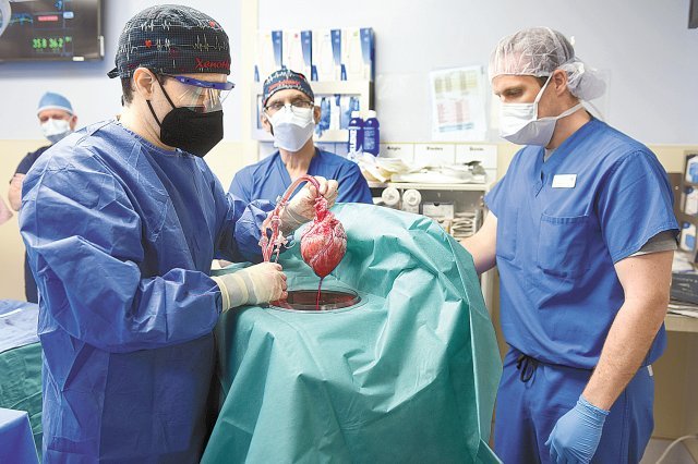 미국 메릴랜드대 의료진이 7일 세계 최초로 유전자 조작 돼지의 심장을 인간에게 이식하는 수술을 진행하면서 유전자를 교정한 돼지의 심장을 들어 보이고 있다. 메릴랜드대 의대 제공