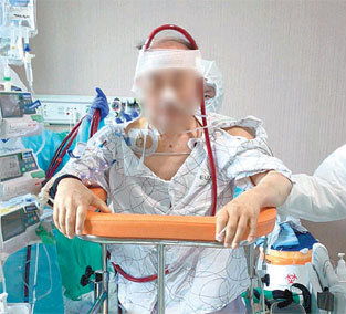 한 60대 남성 환자가 코로나19 감염 이후 이대목동병원에서 에크모(인공심폐기)를 단 채 재활치료를 받고 있다. 이대목동병원 제공