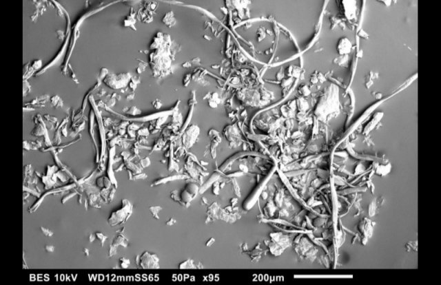 다이슨 미생물연구소에서 현미경으로 관찰한 먼지의 모습. 제공=다이슨