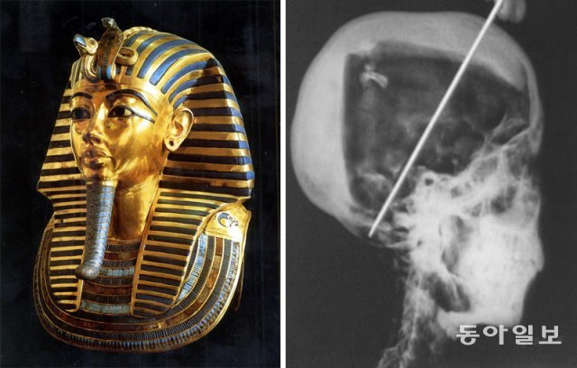 인류는 영생을 꿈꾸며 망자의 육신을 미라로 만들었다. 고대 이집트 파라오 투탕카멘의 황금 마스크(왼쪽 사진). 최근 엑스레이 촬영(오른쪽 사진) 결과 뒷머리에서 구멍이 발견돼 살해설이 불거졌으나 이는 미라를 만드는 과정에서 생긴 상처로 알려졌다. 사진 출처 동아일보DB·위키피디아