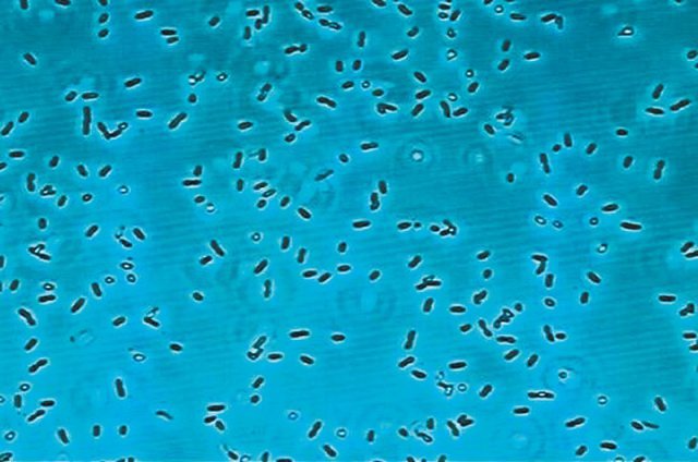 구강유산균(oraCMS1)을 전자현미경으로 촬영한 사진. 오라팜 제공