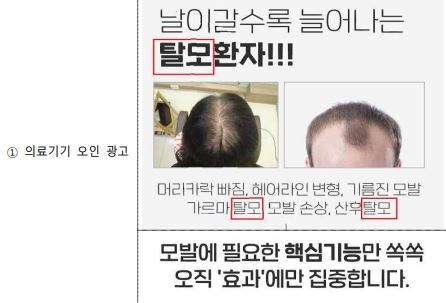 탈모 치료 관련 의료기기 오인 광고 사례. 식품의약품안전처