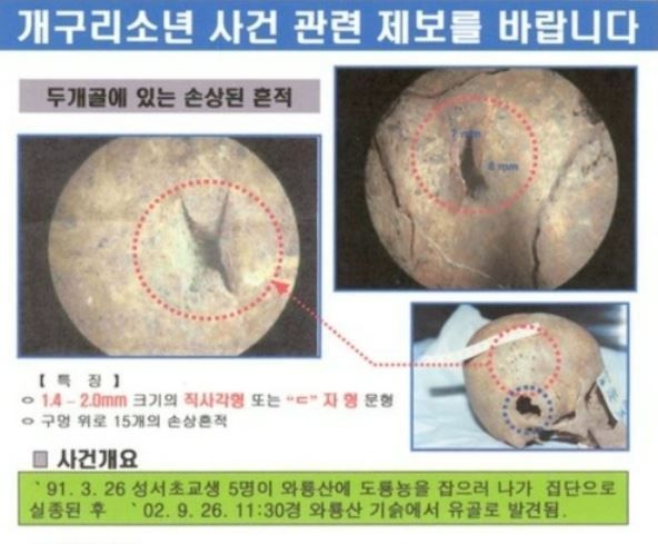 개구리소년 사건 피해 어린이 두개골 사진. (대구 달서경찰서) ⓒ 뉴스1