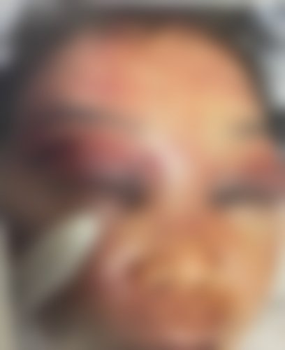 지난 19일 경남 통영의 한 노래방에서 50대 여자 사장 B 씨가 폭행을 당해 병원에서 치료를 받는 모습.(피해자 가족측 제공) 뉴스1