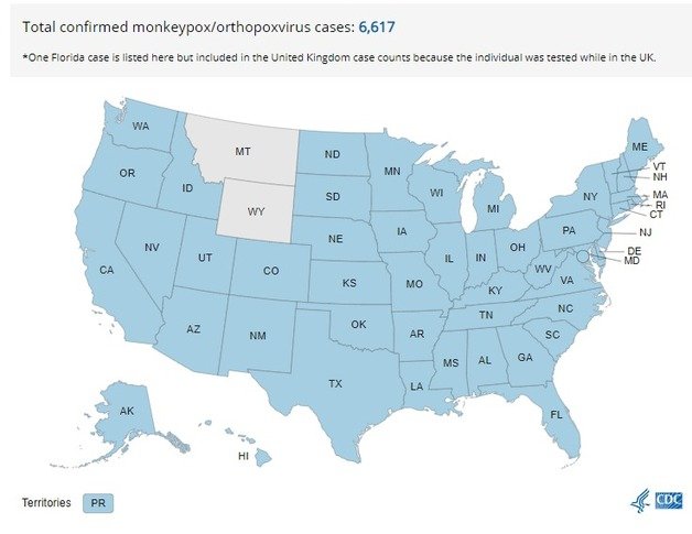 미국 내 원숭이 두창 확산 현황. 미 질병예방통제센터 캡처