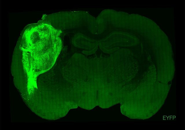 미국 스탠퍼드대 연구팀이 인간 줄기세포로 만든 뇌 오가노이드를 쥐의 뇌에 이식하는 데 성공했다. 왼쪽 밝은 부분이 인간 뇌 오가노이드 모습. 스탠퍼드대 제공