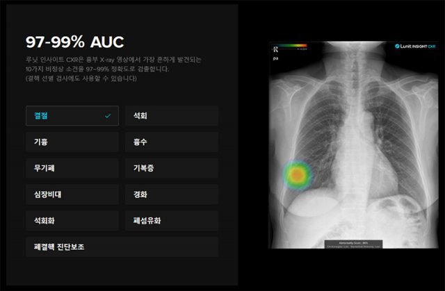 루닛 인사이트 CXR이 판독할 수 있는 증상에 대한 예시. 출처=루닛