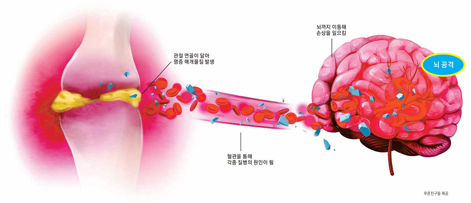 노화 전 연골 보호 8