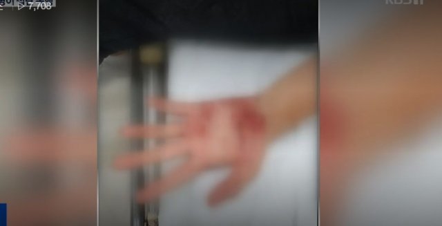 KBS 방송화면 갈무리