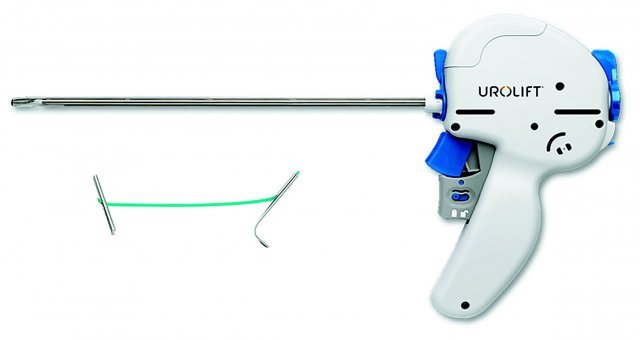 유로리프트는 결찰사로 알려진 특수실을 활용해 전립샘을 묶어 주는 시술이다.