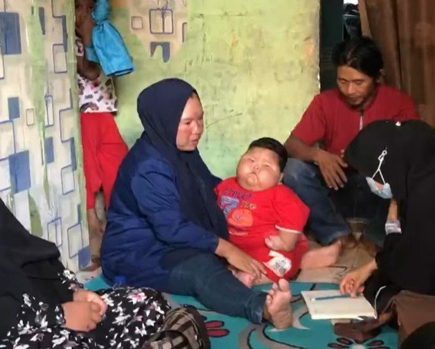 켄지는 아직 스스로 앉거나 기거나 걸을 수 없다. (인도네시아 콤파스TV)