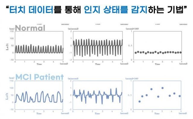 스마트폰 터치 데이터를 통해 경도인지장애를 분석하고자 하는 캘러스컴퍼니, 출처: 캘러스컴퍼니