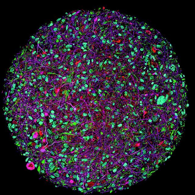 토머스 하퉁 미국 존스홉킨스 블룸버그 공중보건대 교수 연구팀이 실험실에서 배양한 뇌 오가노이드의 확대 이미지. 미 존스홉킨스대 제공