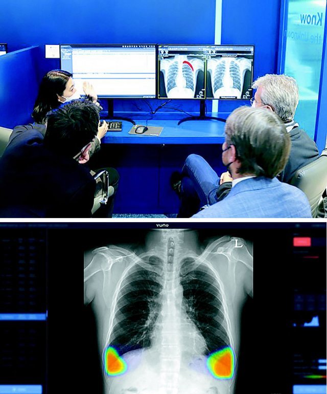 흉부 엑스레이(X-ray) 영상판독 서비스 ‘뷰노메드 체스트 엑스레이’를 개발한 의료 인공지능(AI) 기업 뷰노 관계자들이 
‘뷰노메드 체스트 엑스레이’로 모의 분석한 흉부 엑스레이 결과를 해외 기업인에게 설명하고 있다. 아래쪽 사진은 ‘뷰노메드 체스트 
엑스레이’를 구동한 화면. 뷰노 제공