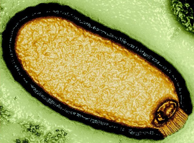 프랑스 엑스마르세유대 연구팀이 영구동토층에서 발견한 고대 바이러스를 현미경으로 관찰했다. 약 4만8500년 동안 영구동토층에서 언 상태로 잠들어 있었다. 엑스마르세유대 제공