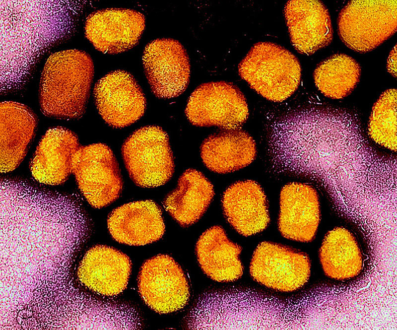엠폭스를 일으키는 원숭이두창 바이러스의 현미경 사진. 사진 출처 위키미디어