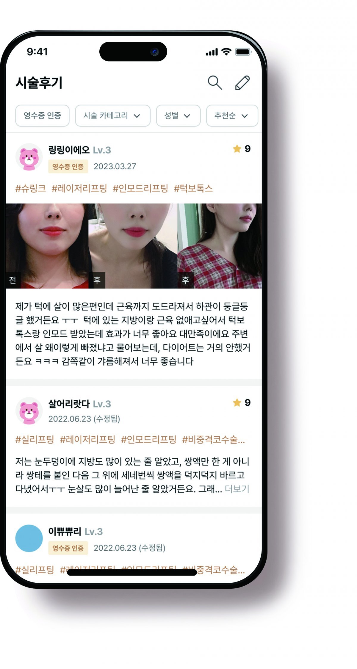 강남언니 앱 이용자가 올린 시술 후기. 힐링페이퍼 제공