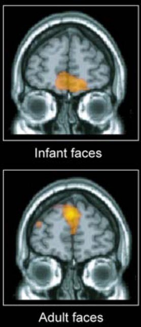 아기 사진을 볼 때(위)와 성인 사진을 볼 때(아래) 뇌에서 반응하는 부위가 각각 다르다. 아기를 볼 땐 기분 좋은 감정을 일으키는 영역이 활성화 된다. PLOS ONE
